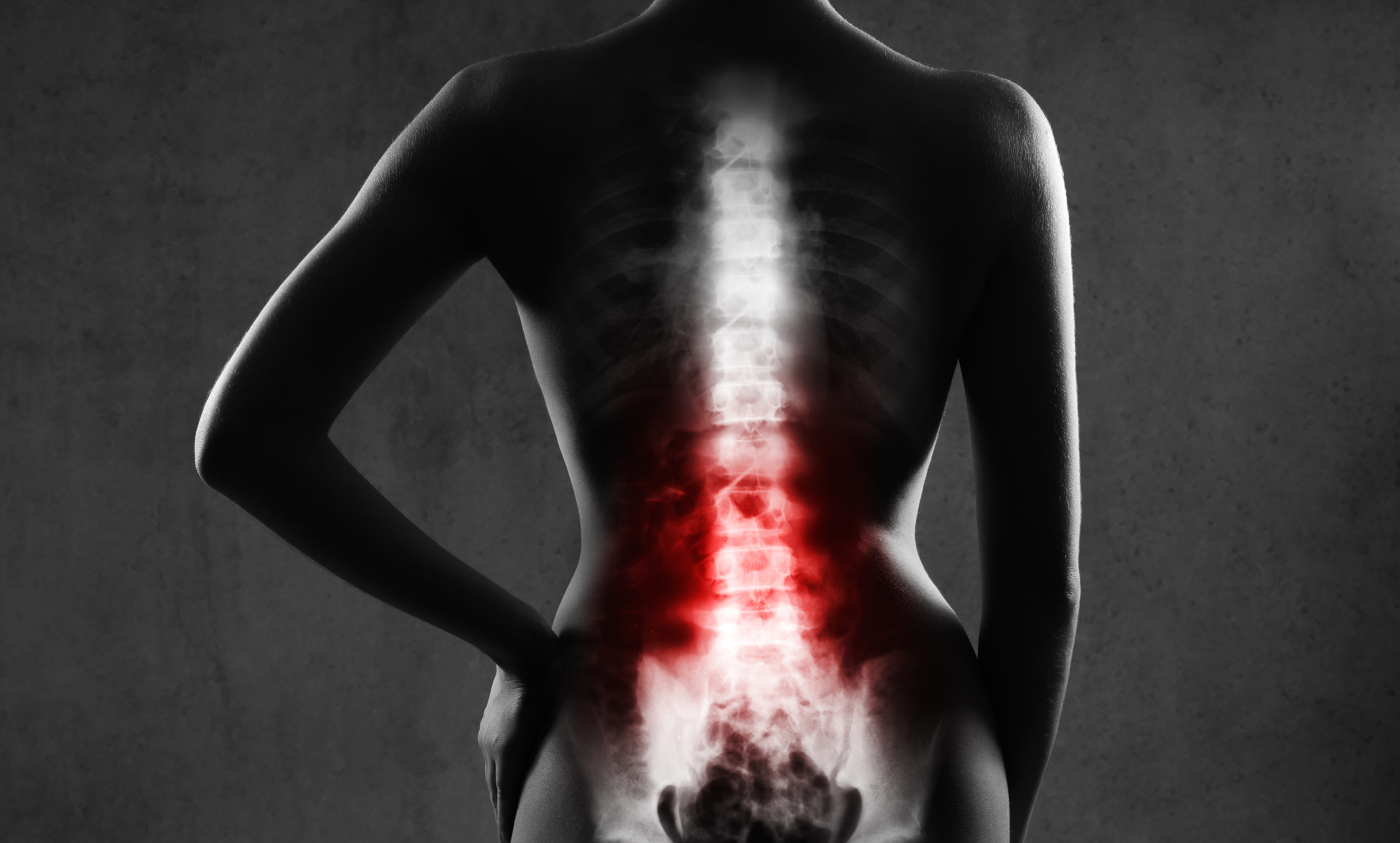 Fusions Treating Low Back Pain