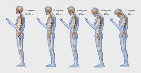 text neck