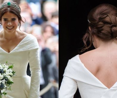 princess-eugenie-scar-1545593378